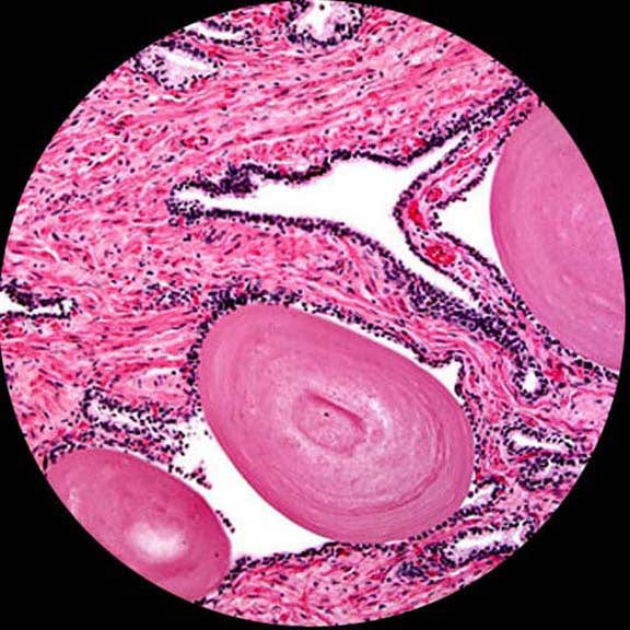 AmScope | Student Microscope | 40X-1000X Portable LED Monocular + 25 Prepared Slides